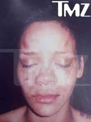 Prima imagine cu Rihanna desfigurata