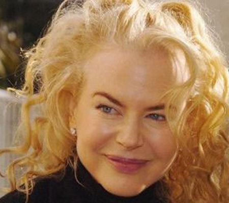 Nicole Kidman desfigurata cu botox