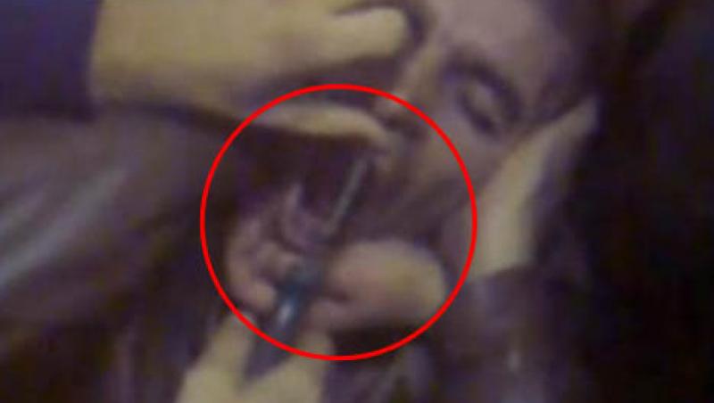 VIDEO! Vezi cum se extrage un dinte cu clestele patent!