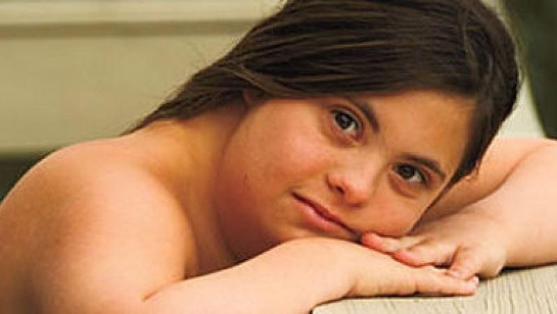 Terapii pentru copiii cu sindromul Down