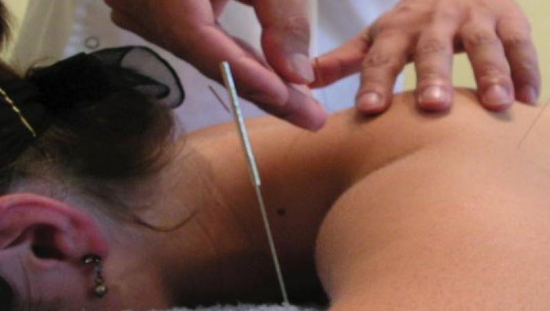 VIDEO! Tot ce trebuie sa stii despre acupunctura