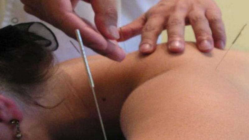 VIDEO! Tot ce trebuie sa stii despre acupunctura