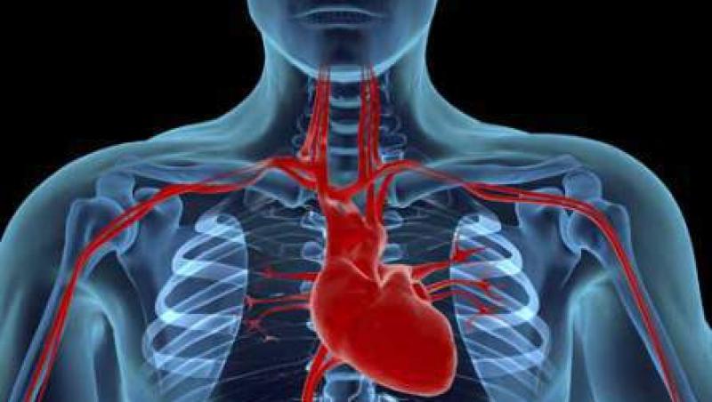 Chirurgia cardiaca repara complicatiile infarctului!