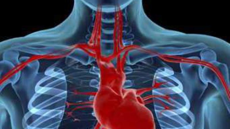 Chirurgia cardiaca repara complicatiile infarctului!