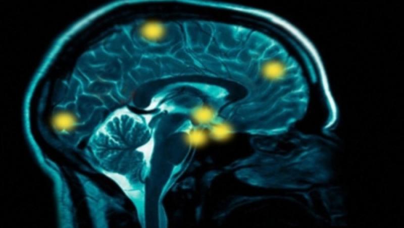Cercetatorii au descoperit o tehnica pentru stergerea permanenta a amintirilor traumatizante