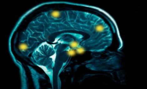 Cercetatorii au descoperit o tehnica pentru stergerea permanenta a amintirilor traumatizante
