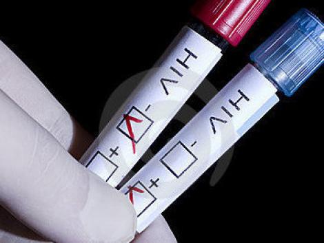 Studiu: O treime din seropozitivii din Europa nu stiu ca sunt infectati cu HIV