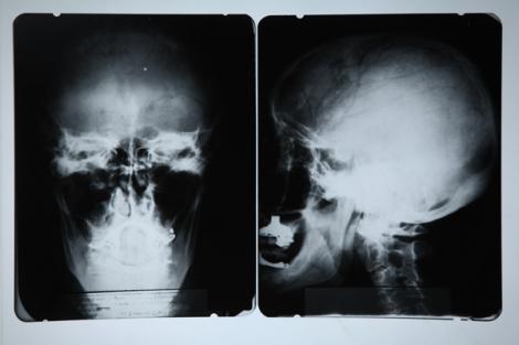 Radiografie craniana a lui Albert Einstein, vanduta cu peste 28.000 de euro