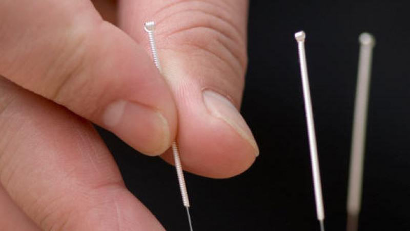 Slabeste folosind acupunctura!