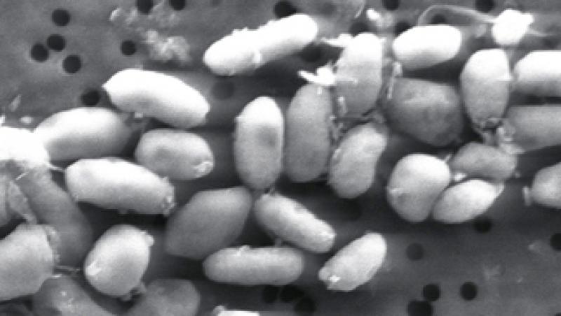 NASA a descoperit o bacterie care traieste in arsenic