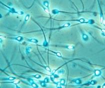 Test de fertilitate pentru barbati, disponibil in curand