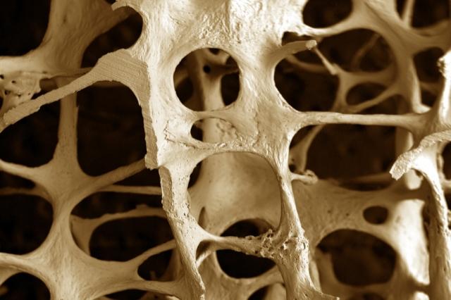Osteoporoza rupe vertebrele