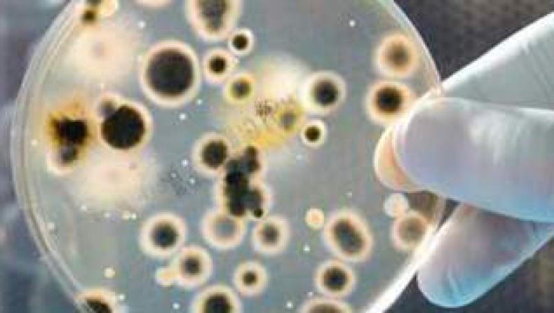Ulcerul este provocat de bacteria “Helicobacter pilori”