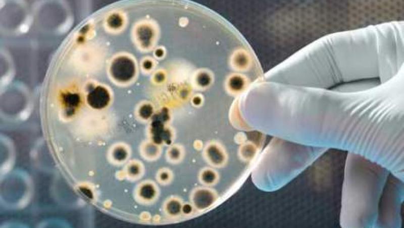 Ulcerul este provocat de bacteria “Helicobacter pilori”