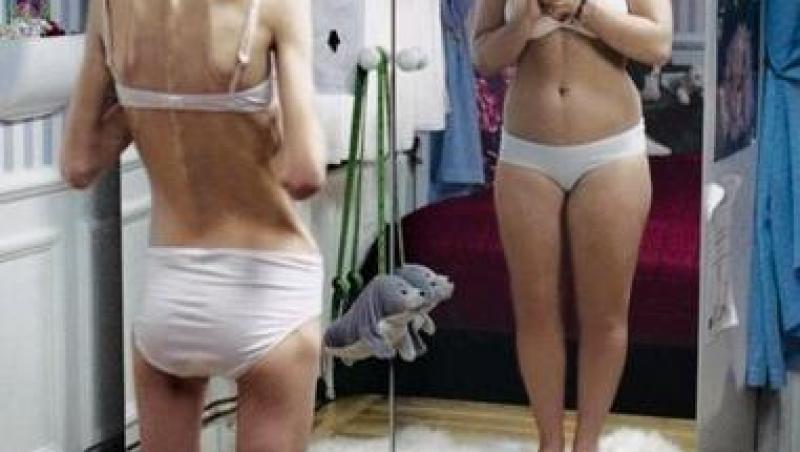 Anorexicii si bulimicii pot primi ajutor in Franta