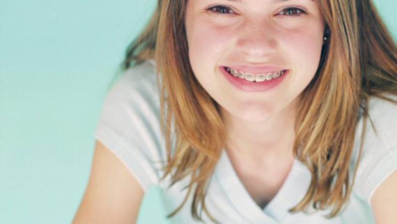Cum se realizeaza un tratament ortodontic la copii