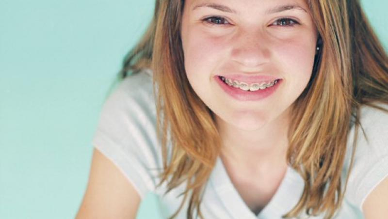 Cum se realizeaza un tratament ortodontic la copii