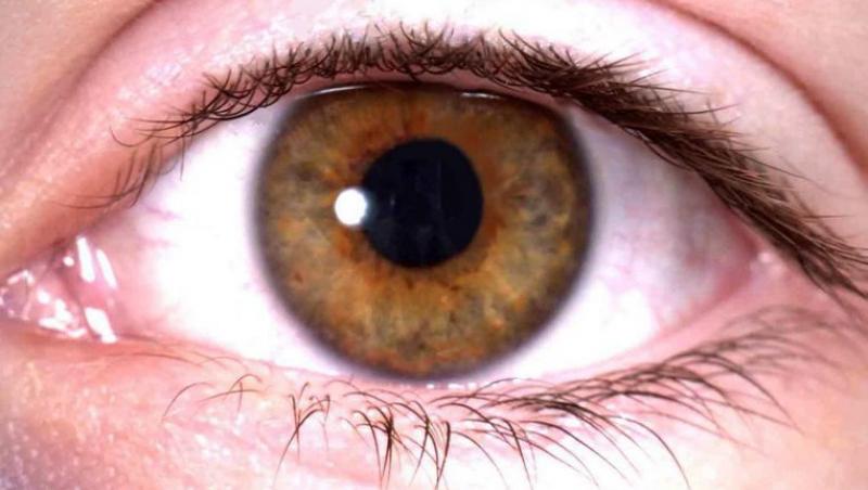 Protejeaza-ti ochii de glaucom