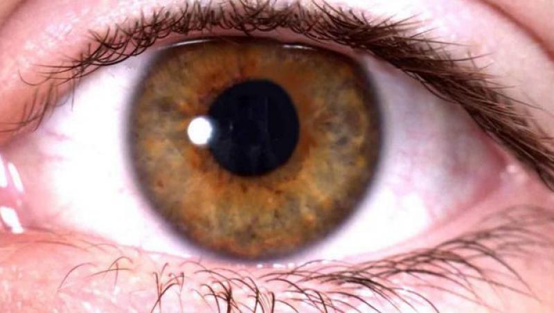 Protejeaza-ti ochii de glaucom