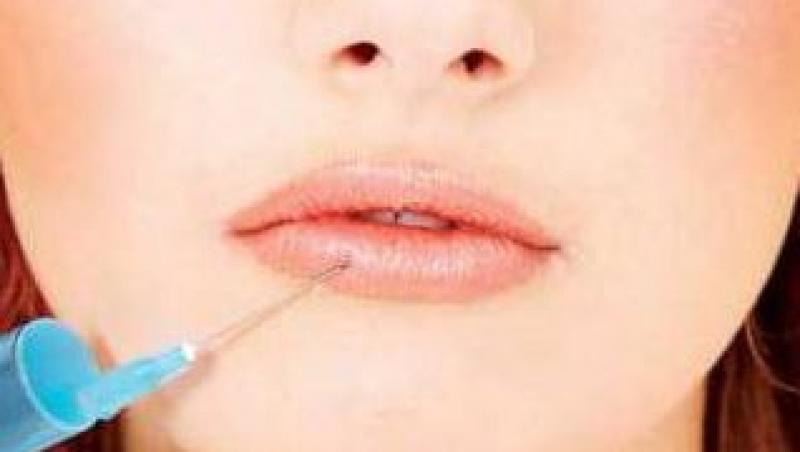 Acidul hialuronic, secretul buzelor senzuale