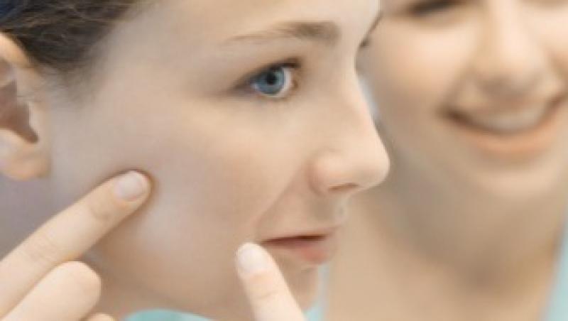 Bolile verii : acneea rozaceea si conjunctivita