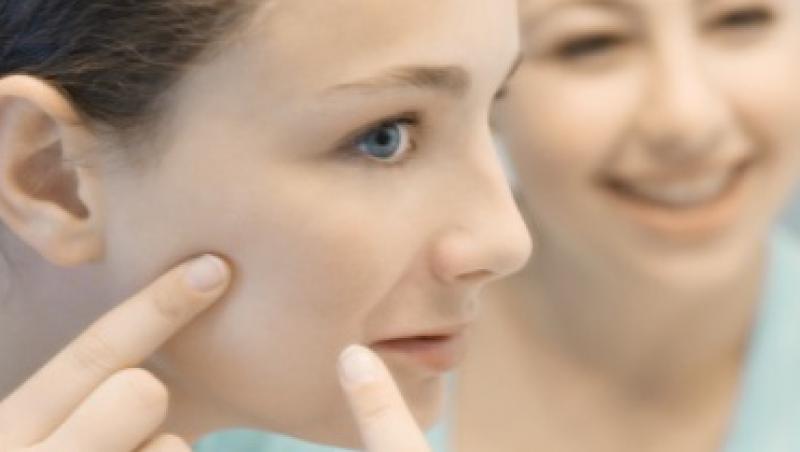Bolile verii : acneea rozaceea si conjunctivita