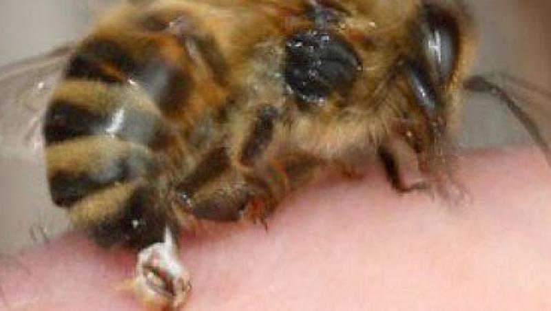 5 sfaturi care te feresc de intepaturile insectelor