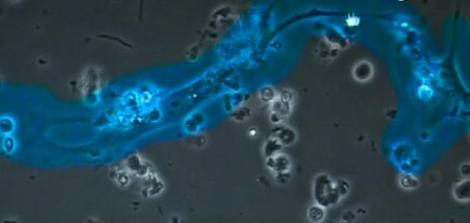 Premiera mondiala: S-a descoperit celula care regeneraza tesuturile bolnave