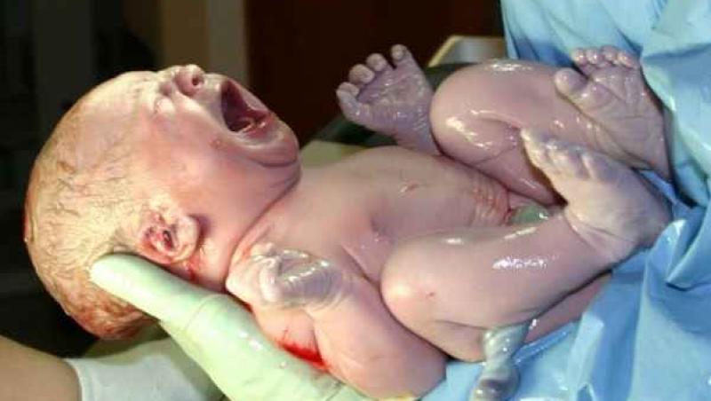 Malformatiile nou-nascutului