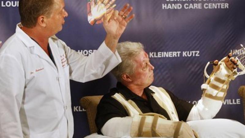 VIDEO! Vezi omul caruia i s-au transplantat ambele maini!
