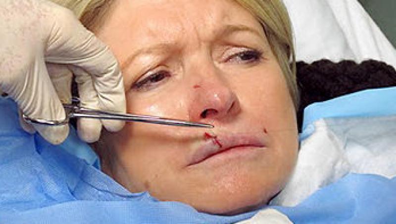 FOTO! Martha Stewart, muscata de propriul caine!