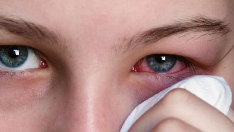 Afectiuni ale ochilor - cauze si tratament