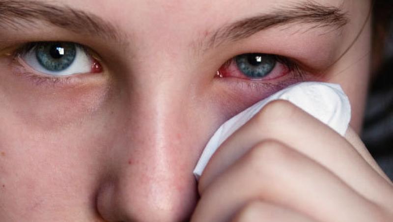 Afectiuni ale ochilor - cauze si tratament