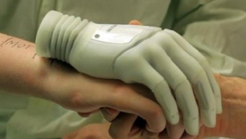 Un craiovean a inventat proteza medicala ce poate fi controlata prin Bluetooth