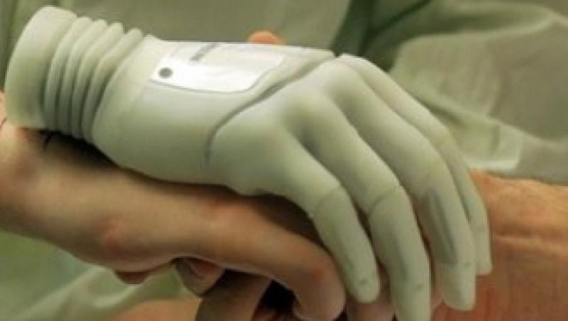 Un craiovean a inventat proteza medicala ce poate fi controlata prin Bluetooth