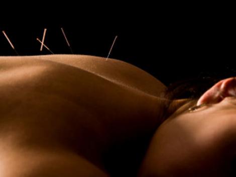 Acupunctura iti readuce energia si pofta de viata