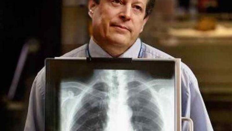 FOTO! Vezi cum arata o radiografie a silicoanelor Pamelei Anderson!