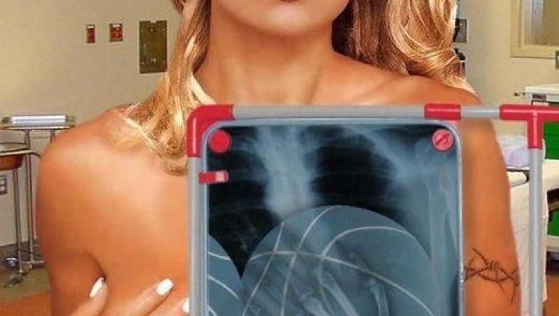 FOTO! Vezi cum arata o radiografie a silicoanelor Pamelei Anderson!
