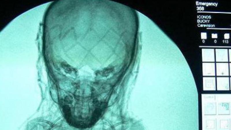 Misterul unei mumii, dezvaluit de o radiografie