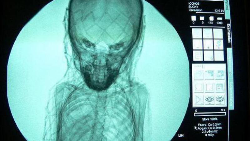 Misterul unei mumii, dezvaluit de o radiografie