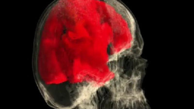 VIDEO! Cum arata creierul femeii in timpul orgasmului!