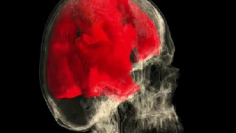 VIDEO! Cum arata creierul femeii in timpul orgasmului!