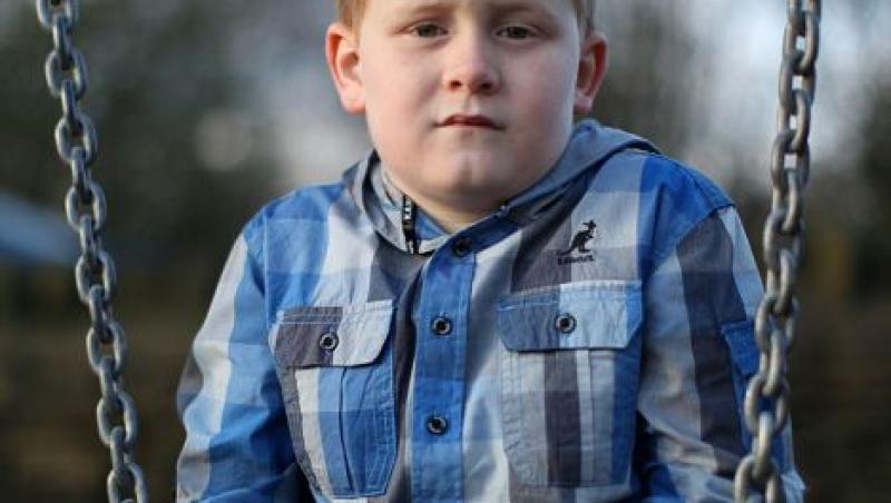 Marea Britanie: un baietel de 7 ani risca sa moara daca rade