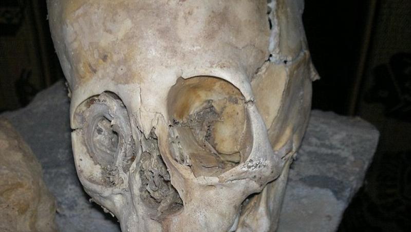 FOTO! Peru: S-a descoperit primul craniu extraterestru
