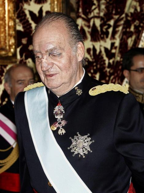 FOTO! Regele Juan Carlos al Spaniei, cu ochiul vanat