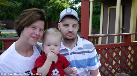 Un fost soldat american desfigurat a facut transplant de fata