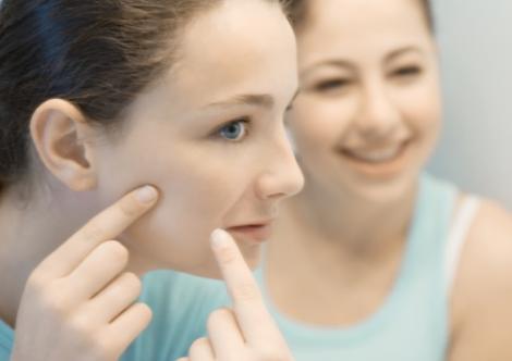 9 solutii naturiste impotriva acneei la adulti