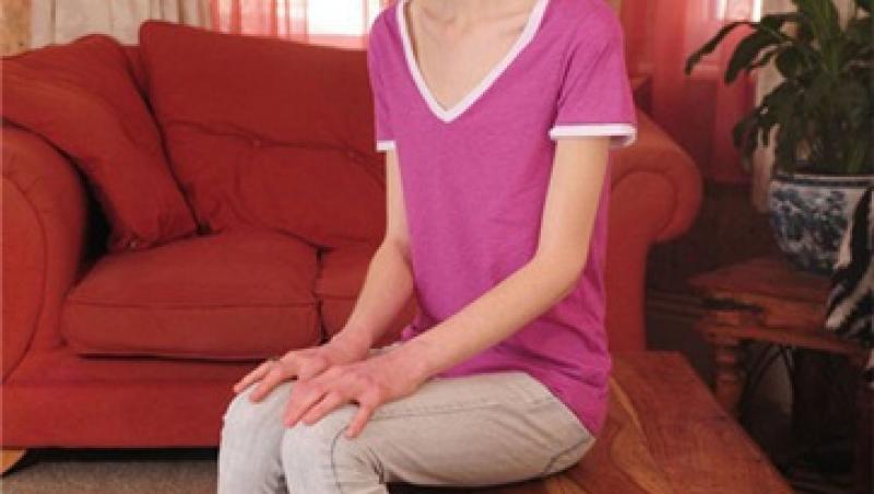Marea Britanie: La 16 ani a devenit anorexic, pentru ca dorea sa fie model