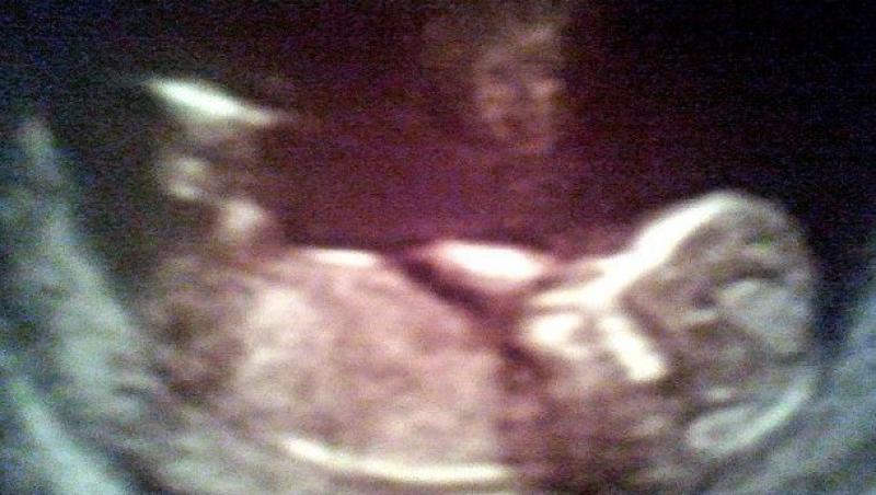 FOTO! Chipul unui inger, intr-o ecografie uterina
