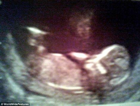 FOTO! Chipul unui inger, intr-o ecografie uterina